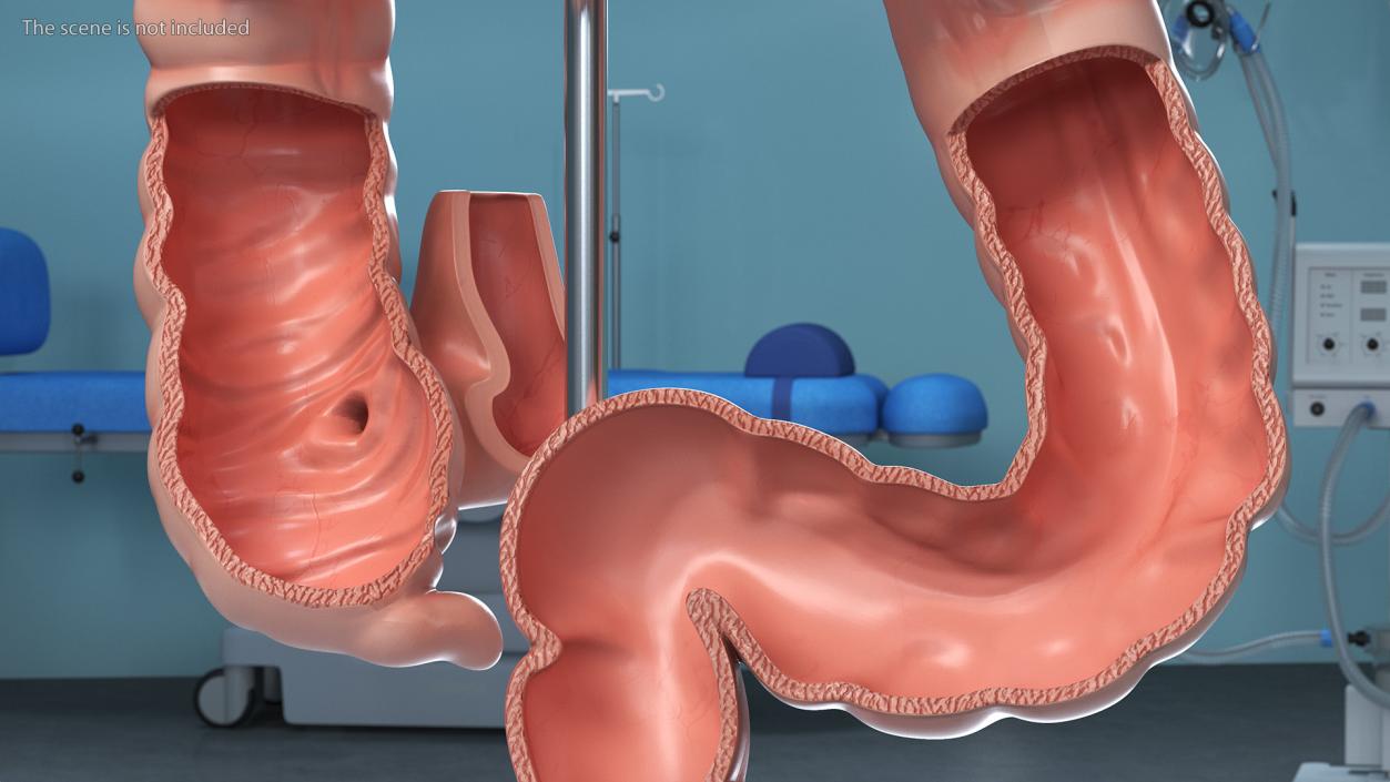 Intestine Medical 3D