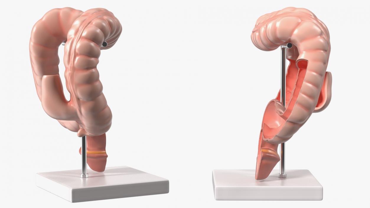 Intestine Medical 3D