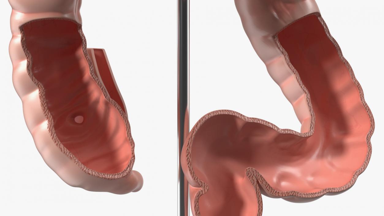 Intestine Medical 3D