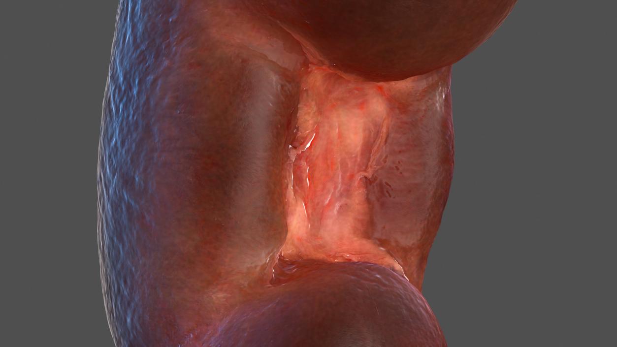 Human Kidney 3D