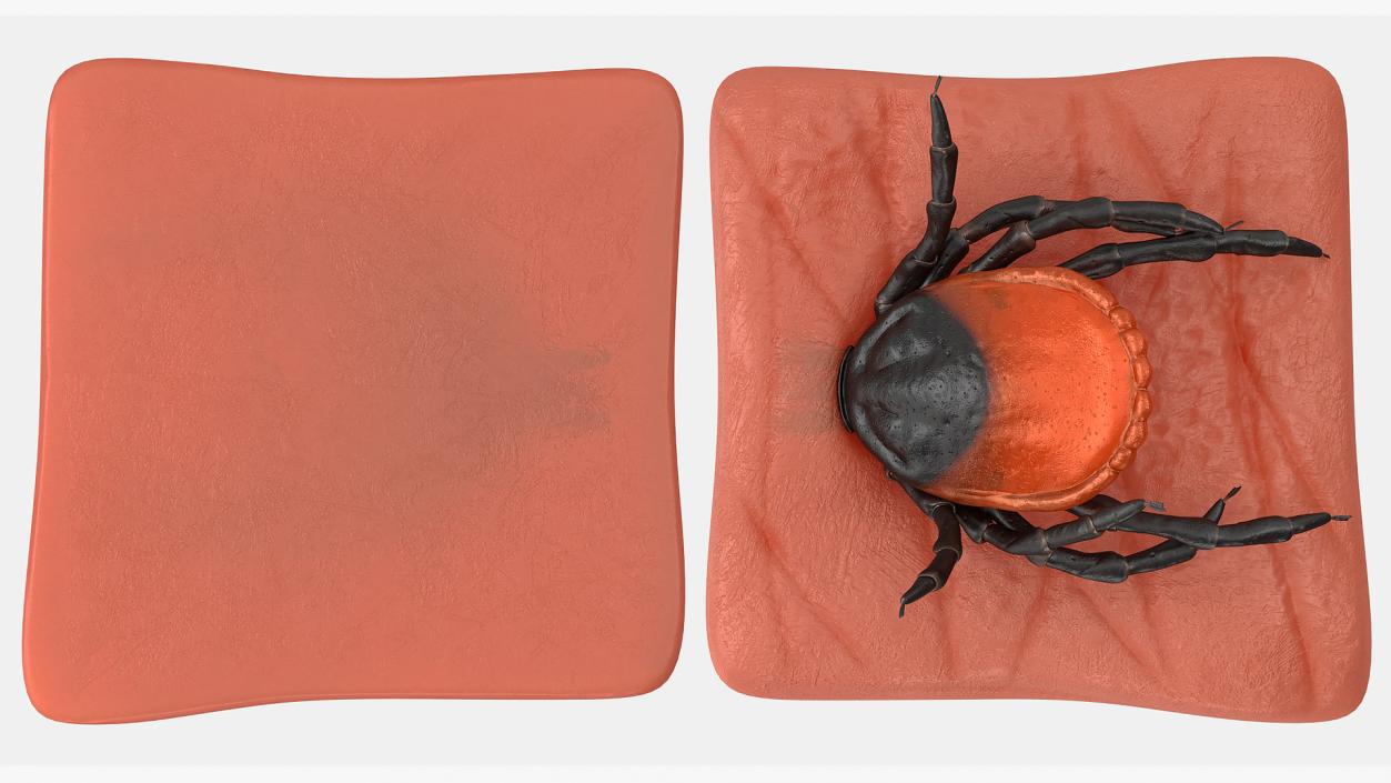 3D Tick Stuck in Skin model