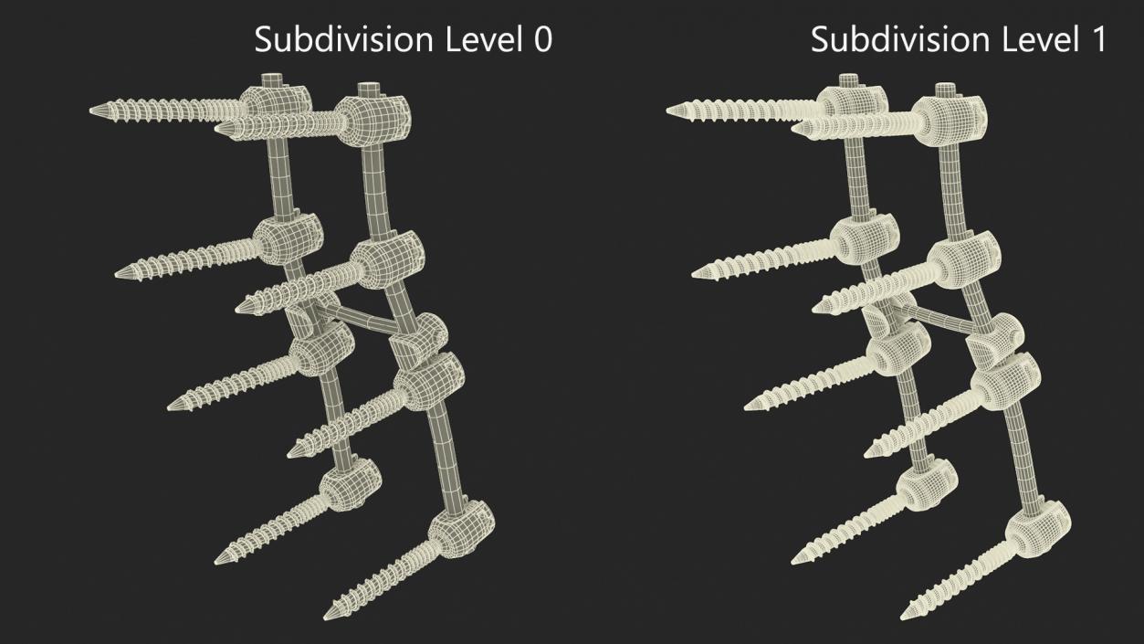 Lumbar Cervical Spine Fixation System 3D