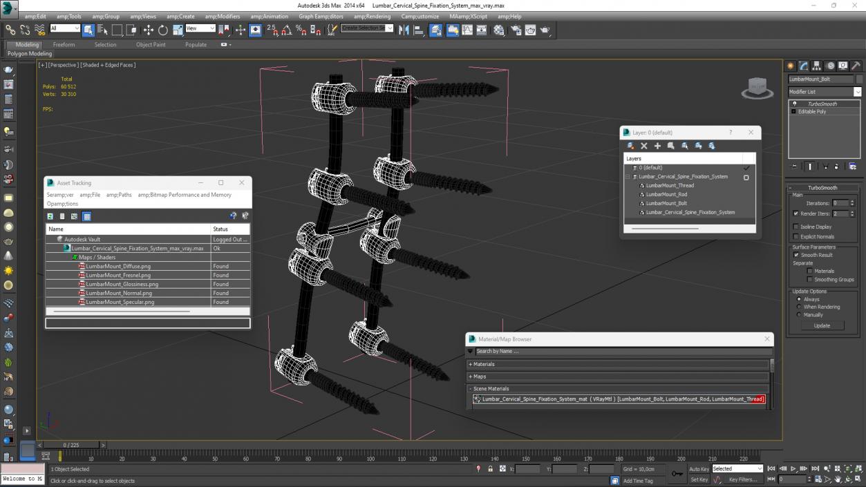 Lumbar Cervical Spine Fixation System 3D