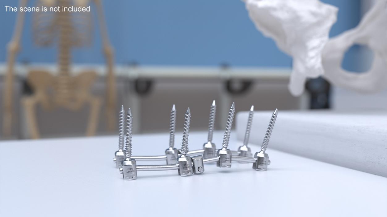 Lumbar Cervical Spine Fixation System 3D