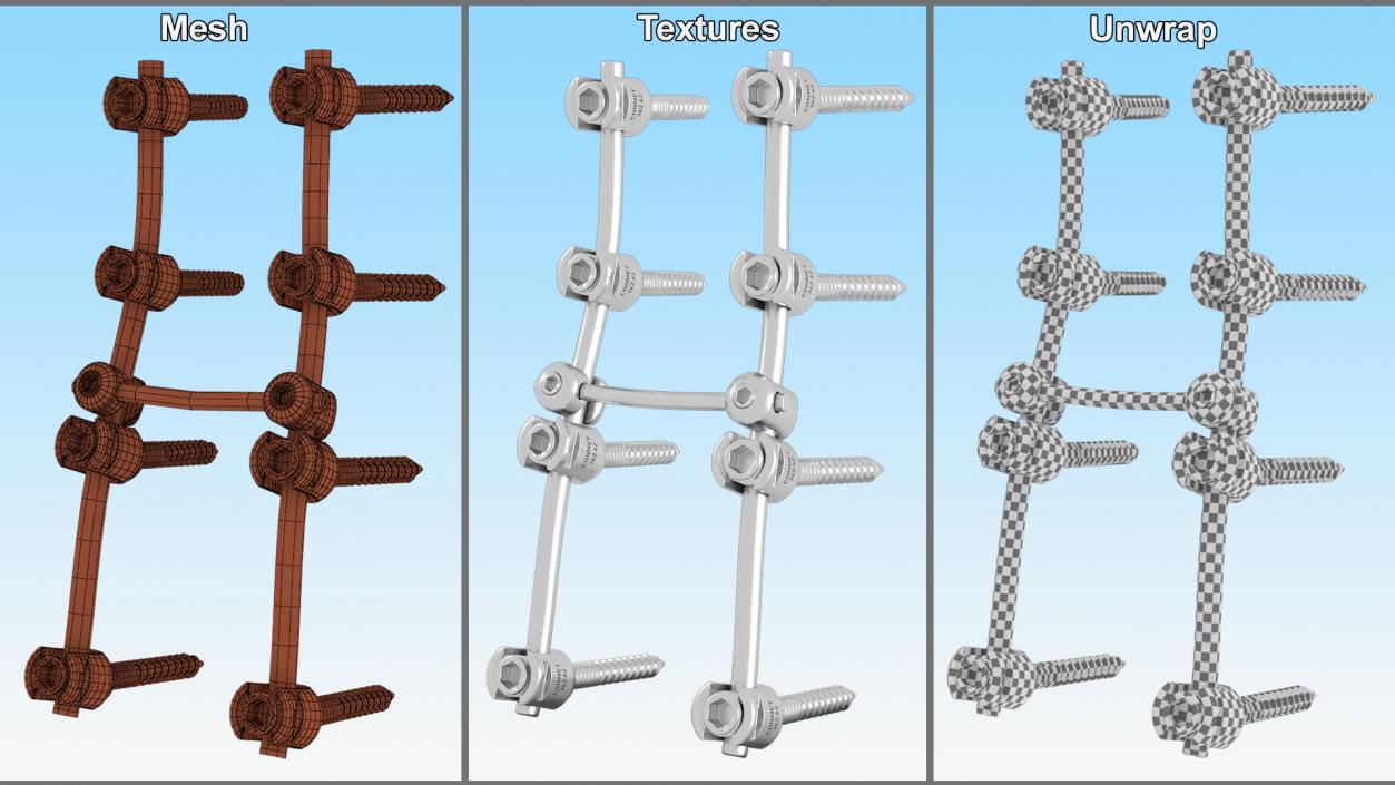 Lumbar Cervical Spine Fixation System 3D