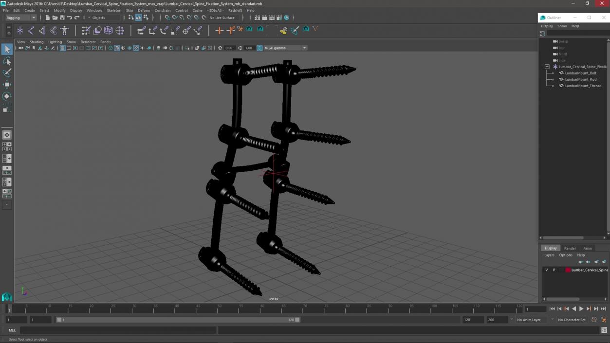 Lumbar Cervical Spine Fixation System 3D