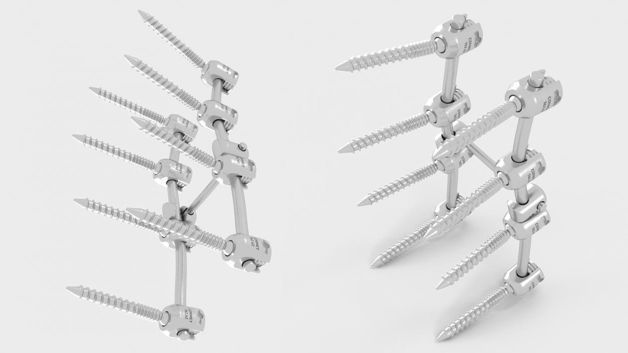 Lumbar Cervical Spine Fixation System 3D