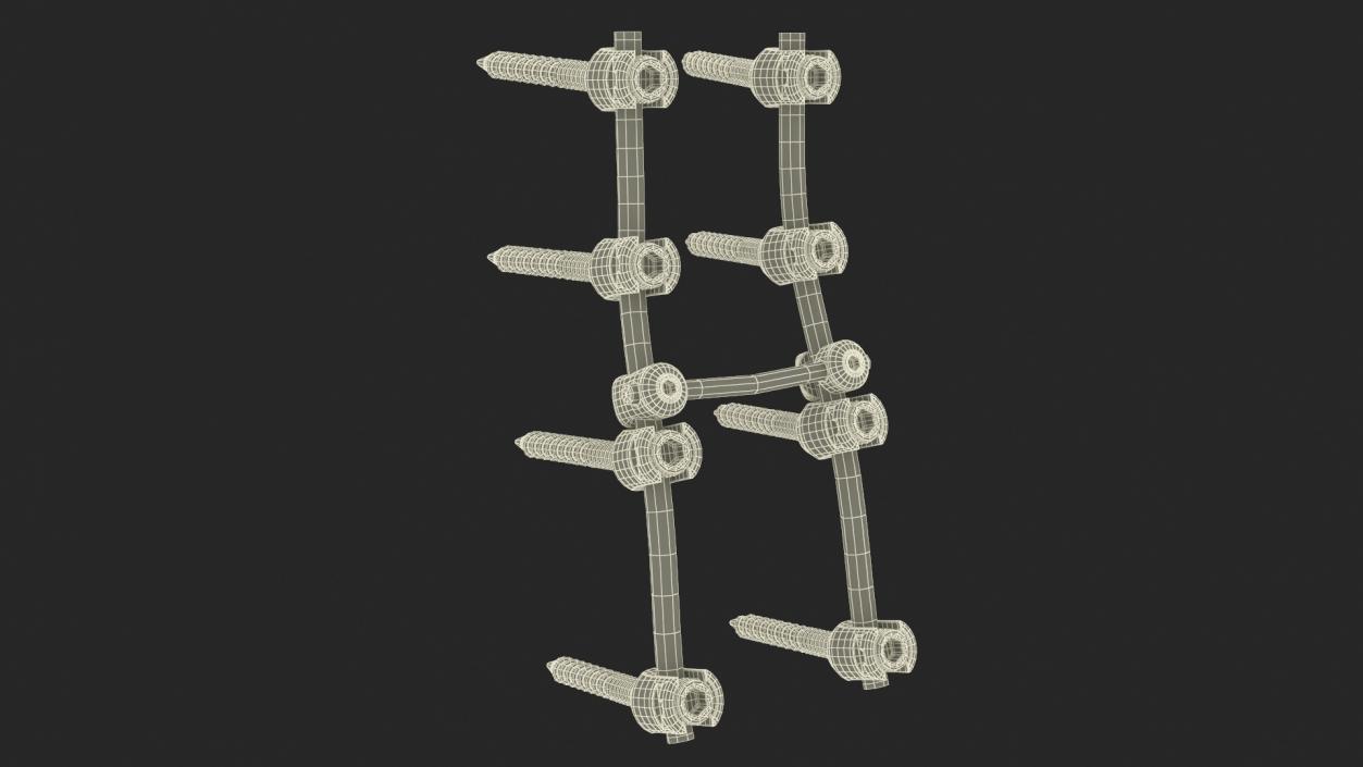 Lumbar Cervical Spine Fixation System 3D