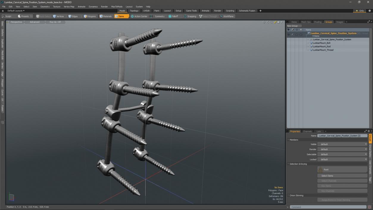 Lumbar Cervical Spine Fixation System 3D