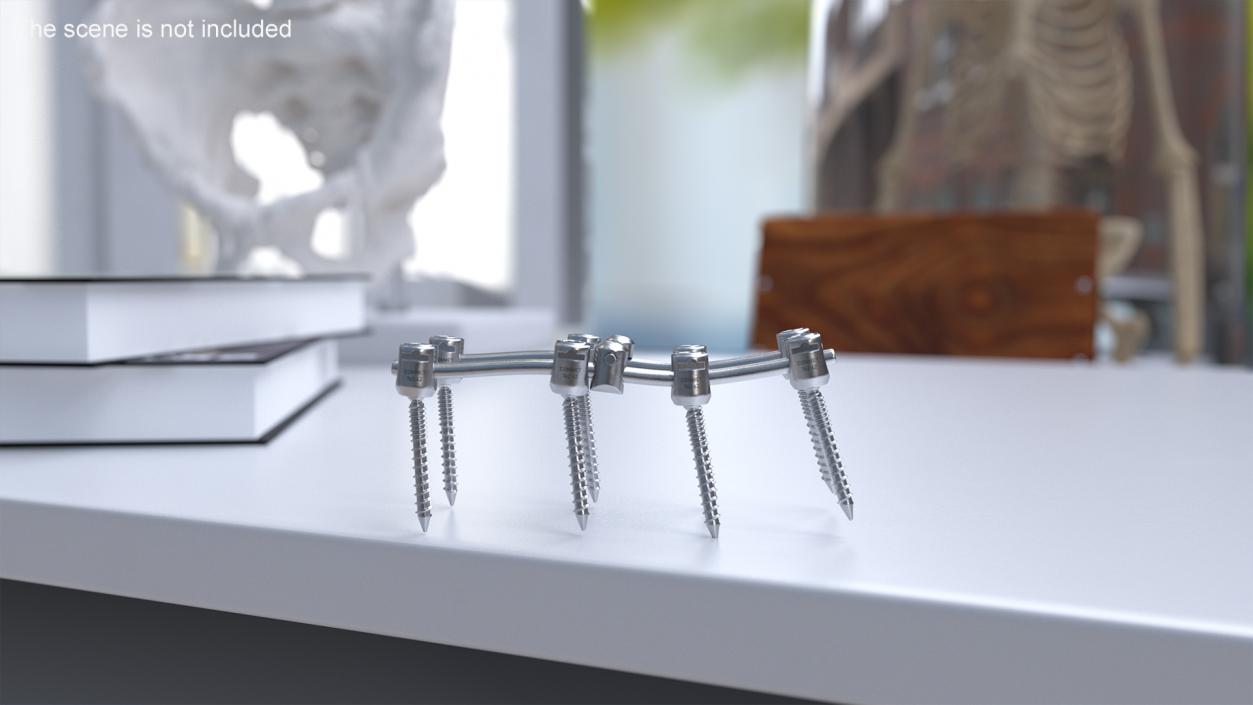 Lumbar Cervical Spine Fixation System 3D