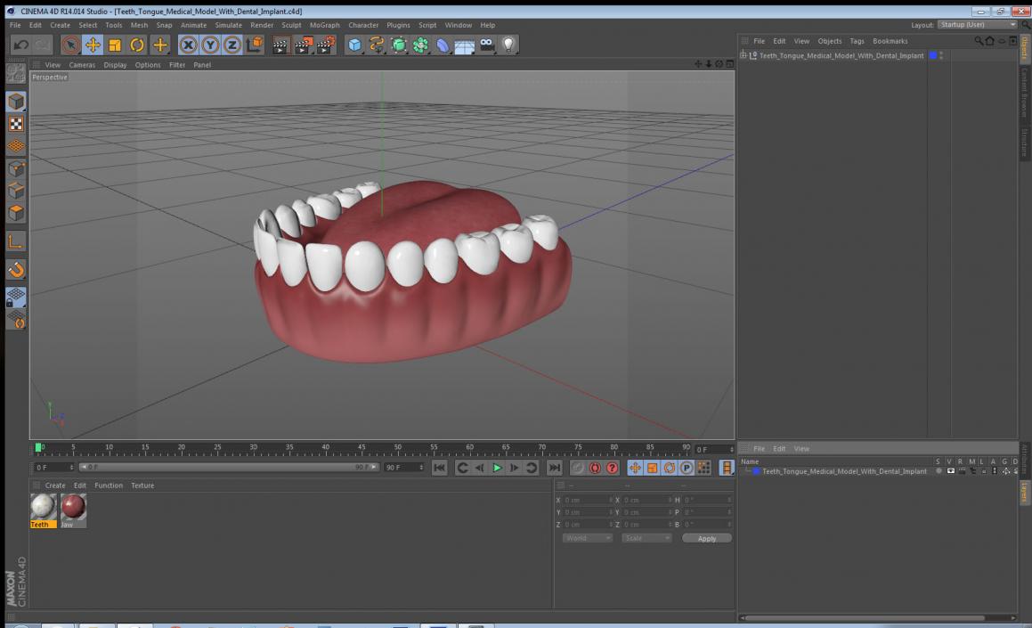 3D Teeth Tongue Medical Model With Dental Implant