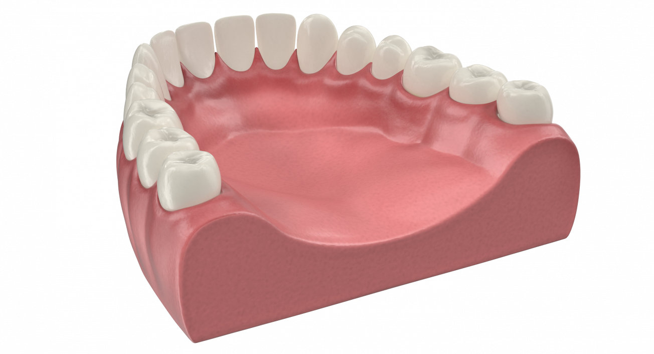 3D Teeth Tongue Medical Model With Dental Implant