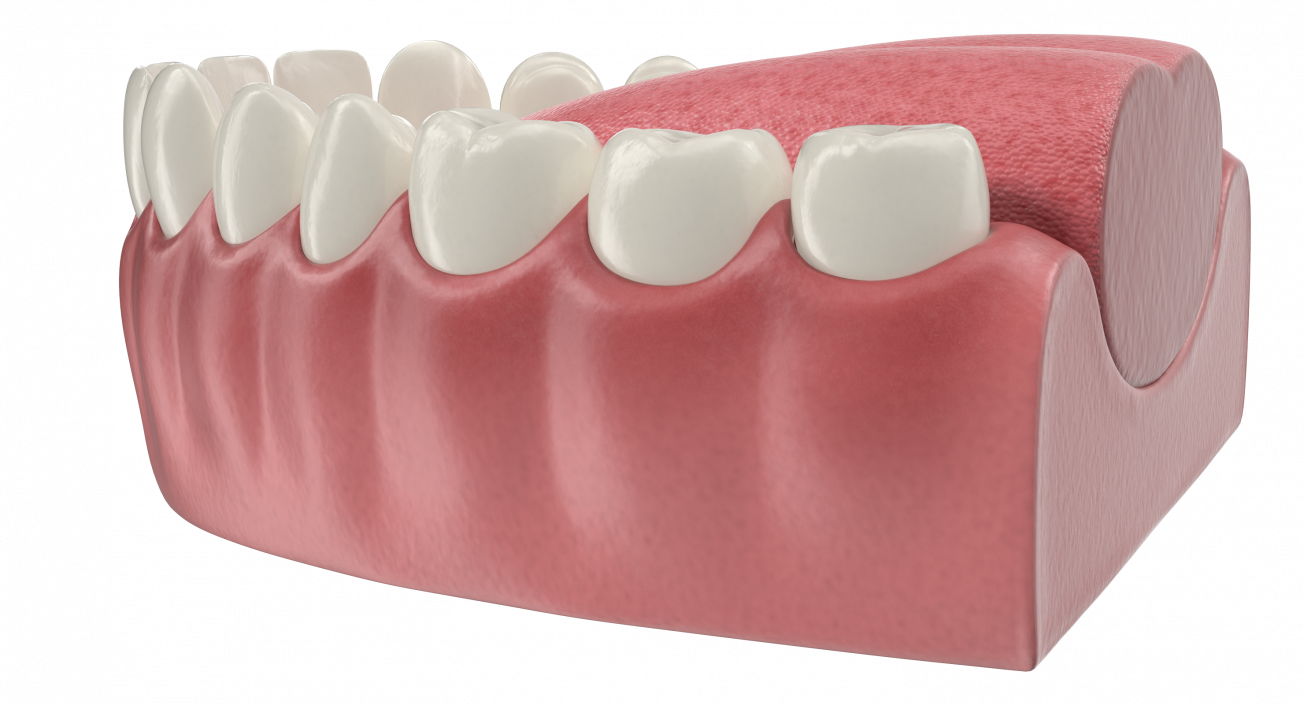 3D Teeth Tongue Medical Model With Dental Implant