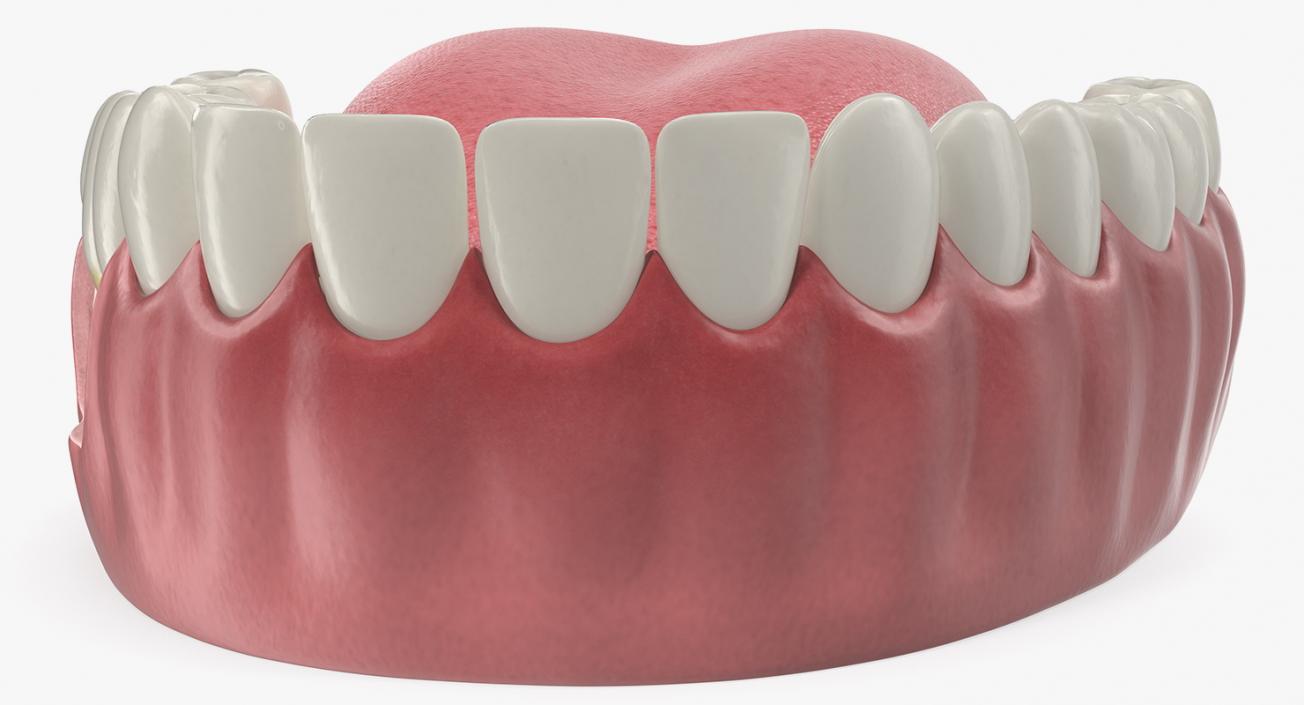 3D Teeth Tongue Medical Model With Dental Implant