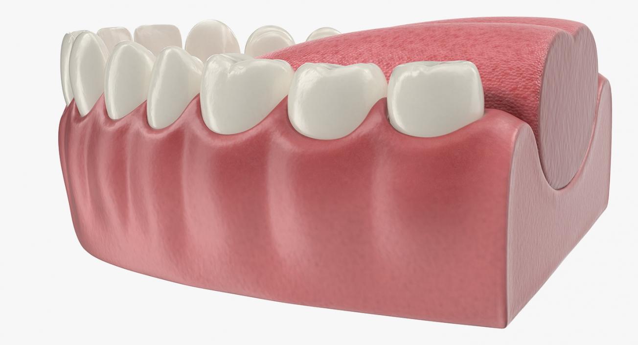 3D Teeth Tongue Medical Model With Dental Implant