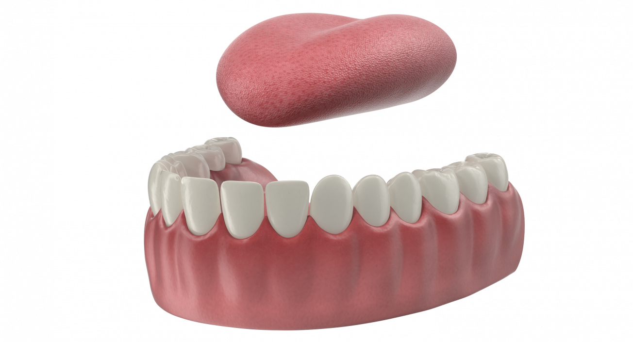 3D Teeth Tongue Medical Model With Dental Implant