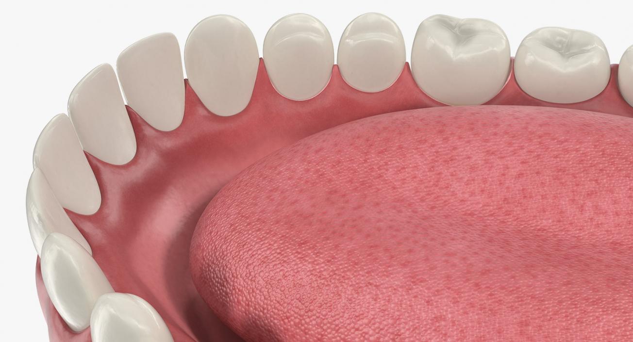 3D Teeth Tongue Medical Model With Dental Implant