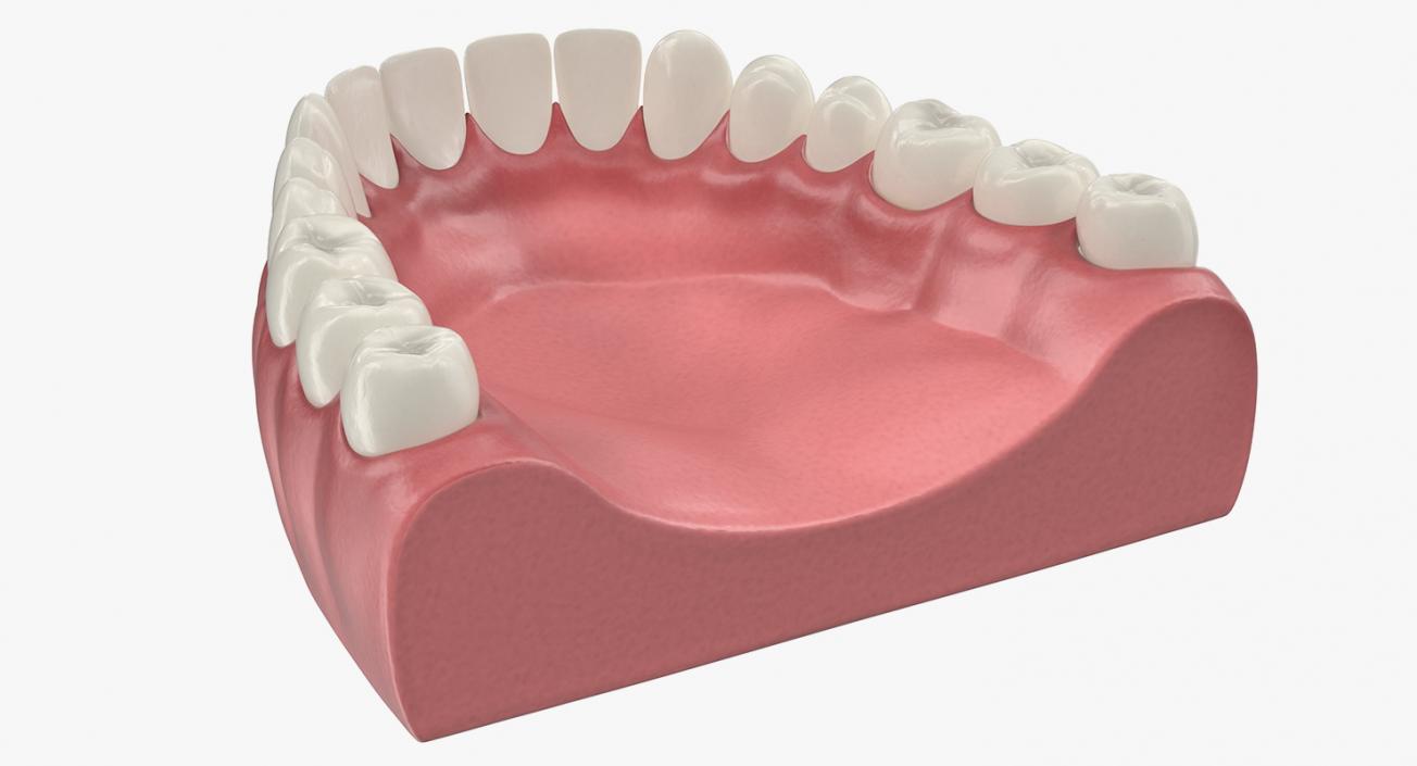 3D Teeth Tongue Medical Model With Dental Implant