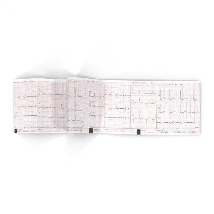 Electrocardiograph Report in Paper Form 3D model