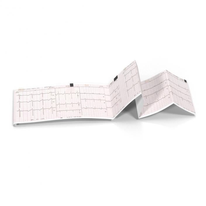 Electrocardiograph Report in Paper Form 3D model