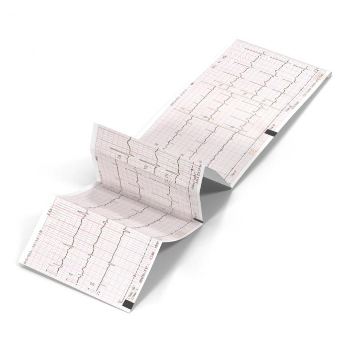 Electrocardiograph Report in Paper Form 3D model