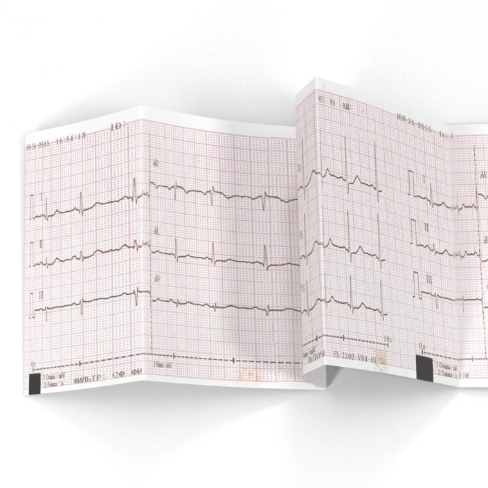 Electrocardiograph Report in Paper Form 3D model