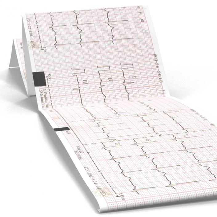 Electrocardiograph Report in Paper Form 3D model