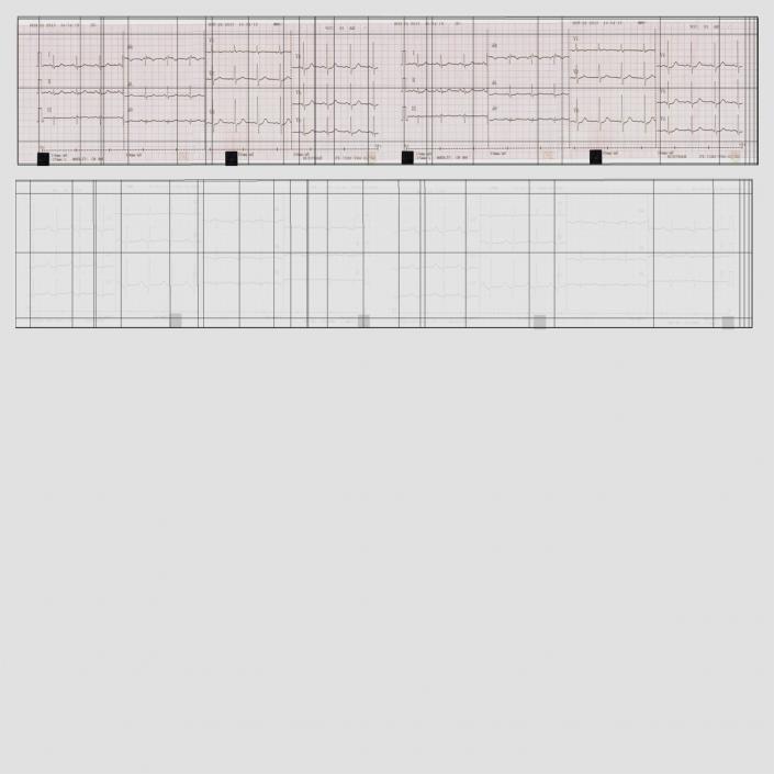 Electrocardiograph Report in Paper Form 3D model