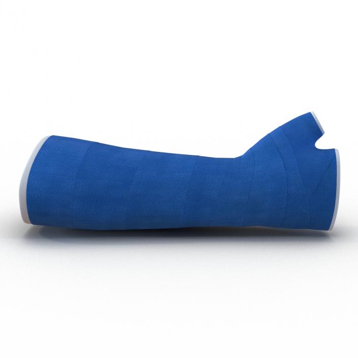 Blue Fiberglass Cast Arm 3D model