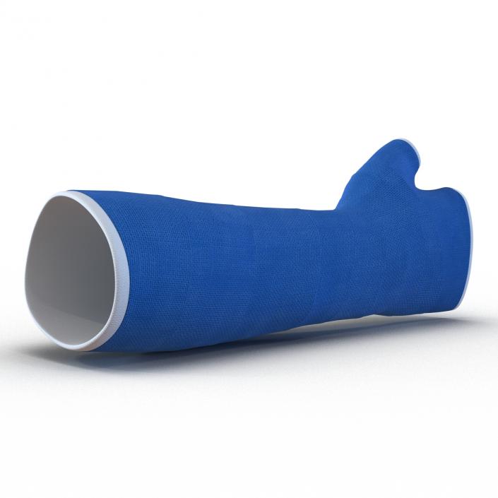 Blue Fiberglass Cast Arm 3D model