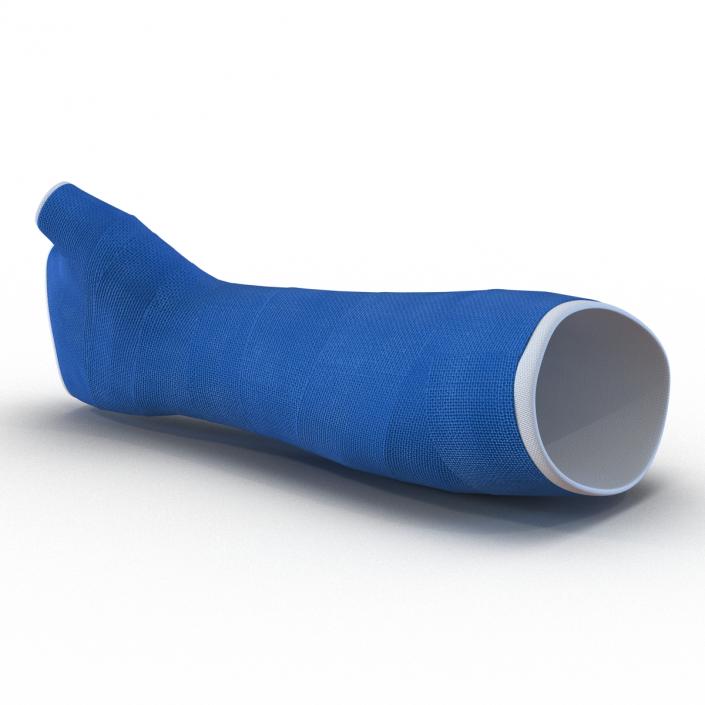 Blue Fiberglass Cast Arm 3D model