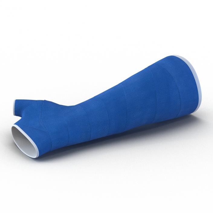 Blue Fiberglass Cast Arm 3D model