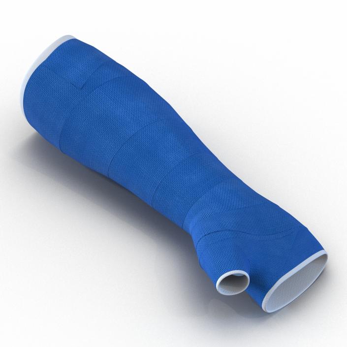 Blue Fiberglass Cast Arm 3D model