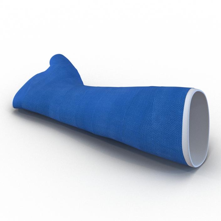 Blue Fiberglass Cast Arm 3D model