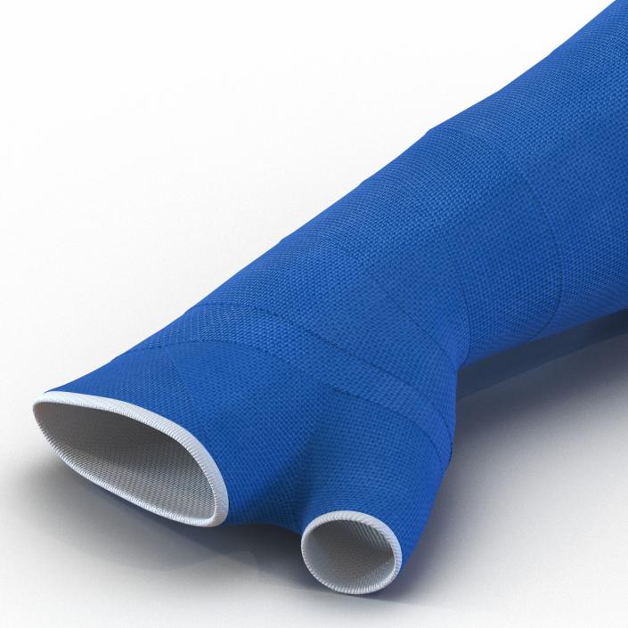 Blue Fiberglass Cast Arm 3D model