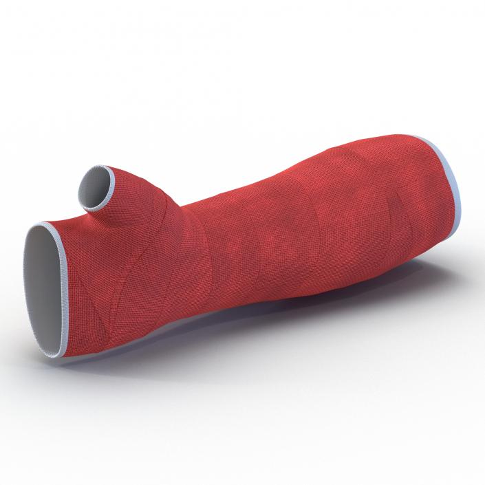 Orthopedic Cast Arm 3D model