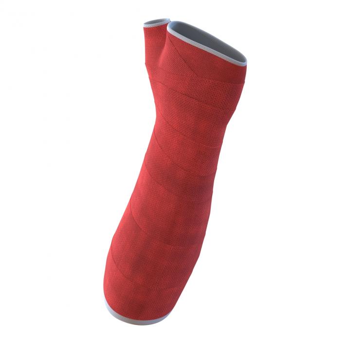 Orthopedic Cast Arm 3D model