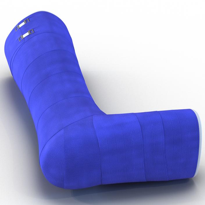 Blue Fiberglass Cast Leg 3D model