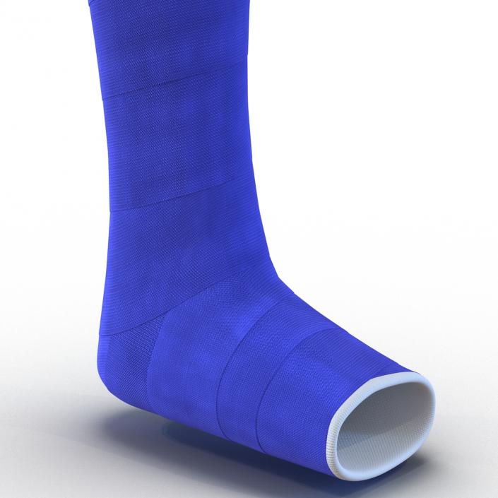 Blue Fiberglass Cast Leg 3D model