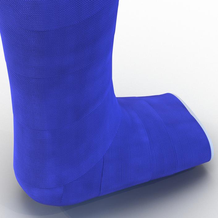 Blue Fiberglass Cast Leg 3D model