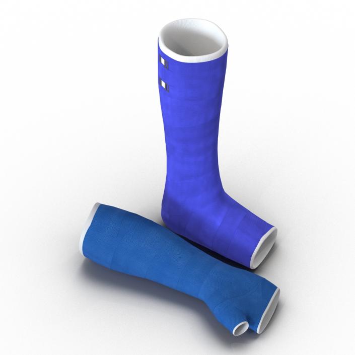 3D Blue Fiberglass Cast Arm and Leg Blue Set