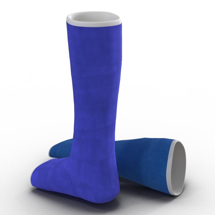 3D Blue Fiberglass Cast Arm and Leg Blue Set