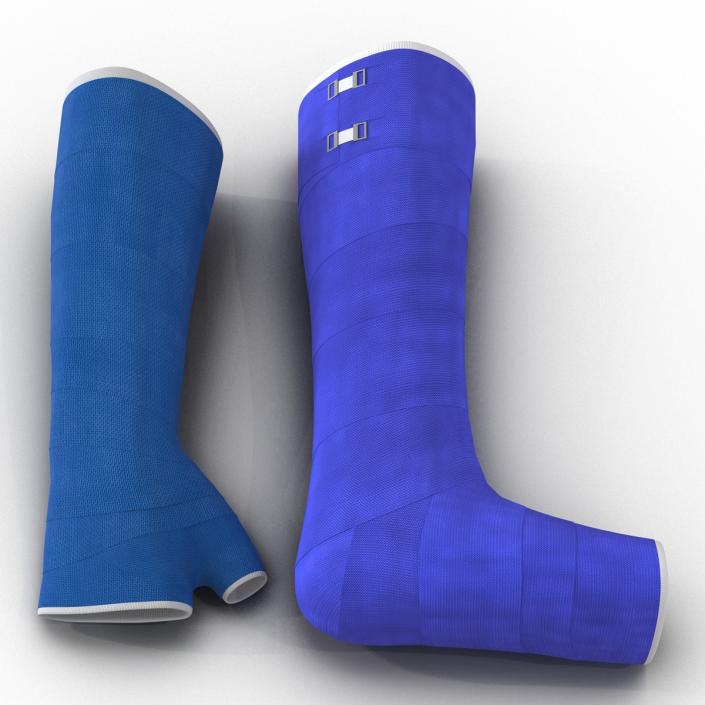 3D Blue Fiberglass Cast Arm and Leg Blue Set