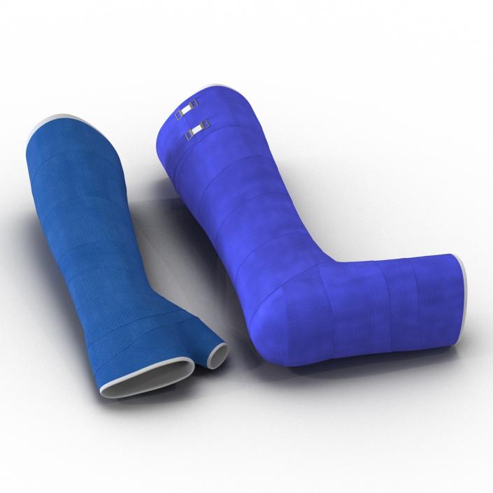 3D Blue Fiberglass Cast Arm and Leg Blue Set