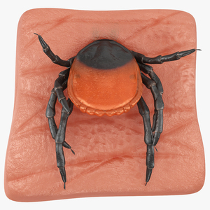 3D Tick Stuck in Skin model