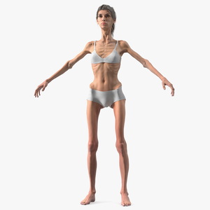 3D Anorexic Woman T-Pose