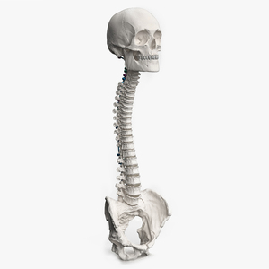 3D Bone Skull and Cervical Spine Fixation Colored
