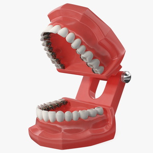 3D Lingual Braces on Typodont Teeth Model model