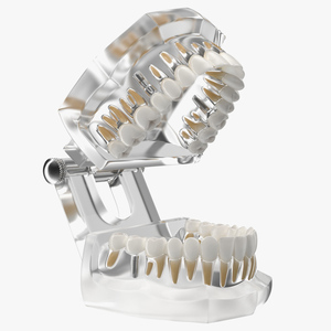 3D Transparent Dental Typodont With Dental Implants model