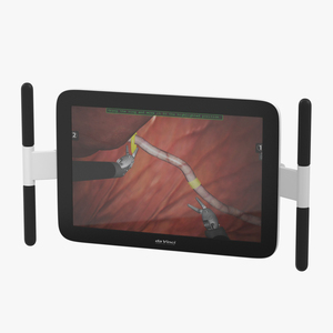 3D Hospital Monitor Wall Mount Arm